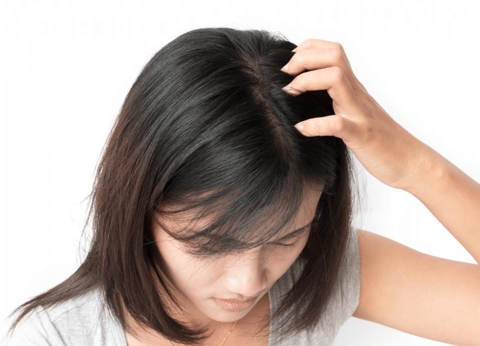 8 Important Facts About Lice Lice Master